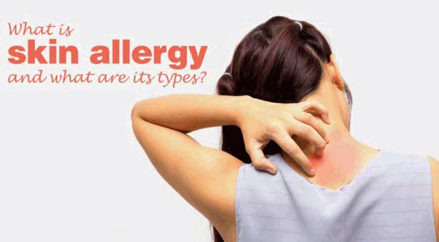 skin-allergy-meaning-types-causes-and-remedy-global-health-info